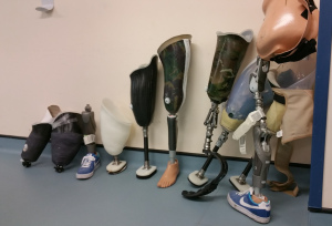 Prosthetic legs lined up